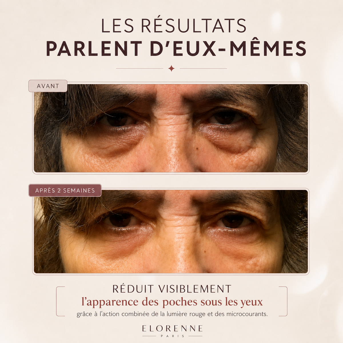 RevaEyes
